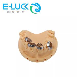 Vendita calda dentale ortodontico fascia molare ortodontica Gap Metal Band staffe <span class=keywords><strong>Bicuspid</strong></span> accessori per il trattamento orale - Product Image 2