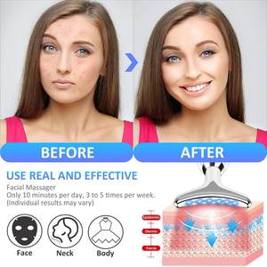 Dispositivo Portátil OEM ODM para Reafirmar la Piel y Masaje Antiarrugas para Levantar la Barbilla, el Cuello y el Rostro, Antienvejecimiento - Product Image 4