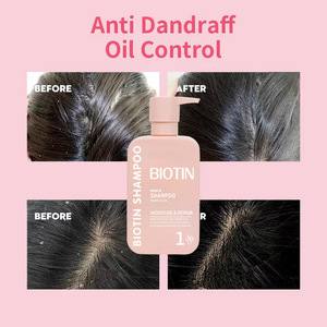 Champú acondicionador de queratina para el cuidado del cabello, conjunto de champú <span class=keywords><strong>y</strong></span> acondicionador de <span class=keywords><strong>biotina</strong></span> hidratante anticaspa rosa de 400ml - Product Image 5