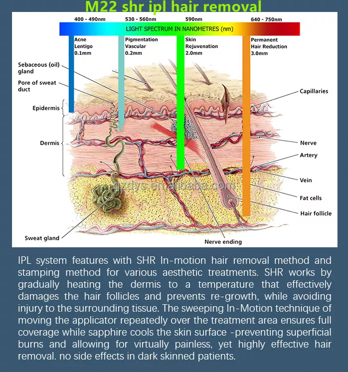 does ipl hair removal work​?