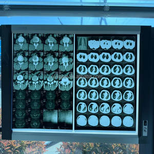 Klinik ve hastane radyolojisi malzemeleri için tıbbi termal <span class=keywords><strong>x</strong></span>-<span class=keywords><strong>ray</strong></span> filmi | <span class=keywords><strong>DICOM</strong></span> uyumlu tıbbi termal kuru görüntü Transfer filmi - Product Image 6