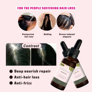 Huile capillaire naturelle et biologique Mega Growth <span class=keywords><strong>Elixir</strong></span>, traitement aux herbes, mélange d'huile d'argan et de romarin pour la croissance <span class=keywords><strong>des</strong></span> cheveux, bienfaits antipelliculaires - Product Image 4