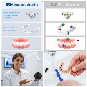 Nettoyeur ultrasonique UV 210 ml pour prothèses dentaires et appareils orthodontiques avec minuterie numérique et alimentation USB - Product Image 6