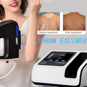 Láser Excimer de Alta Calidad Kernel CE, Láser Excimer de 308 nm para el Tratamiento del Vitiligo - Product Image 3