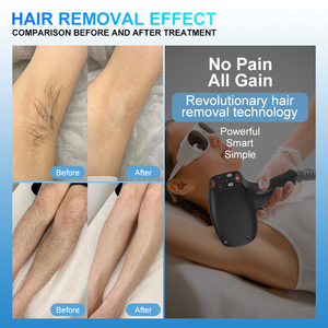 Seaheart Portable 980Nm Diodo Láser Máquina de eliminación vascular Sangre roja Araña Vena Eliminación <span class=keywords><strong>Precio</strong></span> de fábrica para la venta - Product Image 6