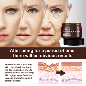 Productos <span class=keywords><strong>de</strong></span> <span class=keywords><strong>belleza</strong></span> Coreanos para el cuidado <span class=keywords><strong>de</strong></span> la piel facial, crema hidratante antienvejecimiento, productos <span class=keywords><strong>de</strong></span> <span class=keywords><strong>belleza</strong></span> para mujer, venta al <span class=keywords><strong>por</strong></span> <span class=keywords><strong>mayor</strong></span> - Product Image 4