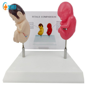 Tài Nguyên giải phẫu để so sánh tác hại của việc hút thuốc trên máy tính để bàn và thai nhi khỏe mạnh trong giảng dạy y khoa - Product Image 1