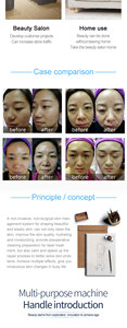 Nuevo Sistema de Cuidado de la Piel, Hidrodermoabrasión con Chorro de Agua, Máquina de Belleza Facial, Limpieza Profunda, Calmante, Reparadora, Eliminación de Puntos Negros - Product Image 5