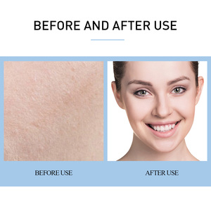 เซรั่มไฮยาลูรอนิก แอซิด LANBENA คุณภาพสูง บำรุงผิวหน้า ช่วยฟื้นฟูผิวแห้ง - Product Image 3