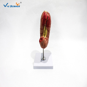 Modèle d'inflammation gastrique, modèle d'anatomie pathologique, aides pédagogiques et de formation médicales pour les lésions d'inflammation gastrique. - Product Image 4