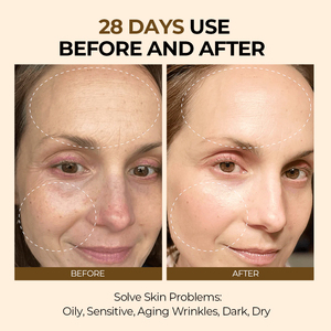 Cuidado DE LA PIEL orgánico coreano 5 en 1 Multifuncional Antiaing Blanqueamiento Iluminador Crema facial Hidratante facial - Product Image 5