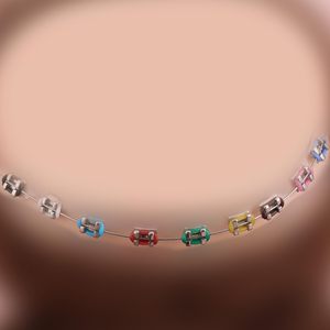 Colorful Braces Decoration Set, Glue Points Teeth Dressing Accessories for DIY Decor and Fun Display - Product Image 4