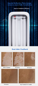 Kernel KN-4006BL Thérapie par lumière ultraviolette UV, <span class=keywords><strong>solution</strong></span> hautement efficace 311nm UVB pour le traitement du vitiligo et des troubles cutanés - Product Image 6