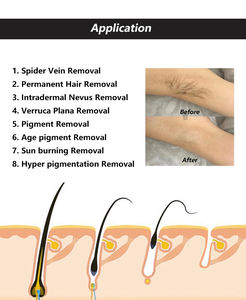Depilación permanente de electrólisis Rbs de oro de alta calidad con aguja Eliminación de venas de araña Operación fácil - Product Image 3