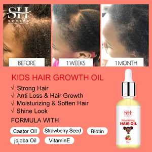 Aceite de ricino natural de etiqueta privada, vitamina E, aceite de <span class=keywords><strong>suero</strong></span> para el crecimiento del cabello para <span class=keywords><strong>niños</strong></span>, antipérdida de cabello - Product Image 2