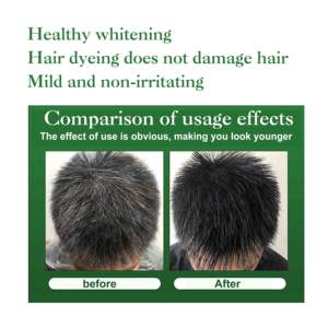 DR.DAVEY Black Hair <strong>Shampoo</strong> for Men&amp;<strong>women</strong> Give You Black Hair Everyday Good Quality - Product Image 4