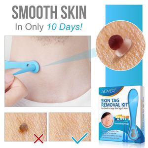 OEM Private Label Auto <strong>Skin</strong> <strong>Tag</strong> <strong>Removal</strong> Kit <strong>Skin</strong> Repair Tools Wart Remover <strong>Patch</strong> Easy Use 2 in 1 Micro <strong>Skin</strong> <strong>Tag</strong> Remover Kit - Product Image 5
