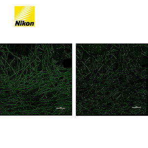 Le système de <span class=keywords><strong>microscope</strong></span> à super-résolution N-STORM offre une résolution dix fois supérieure aux microscopes optiques standard. - Product Image 5