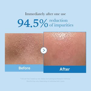 Medicube Zero Pore - Aceite Limpiador de Puntos Negros y Desmaquillante para Todo Tipo de Piel, Limpiador Facial Hidratante Diario, Cuidado de la Piel Coreano - Product Image 6