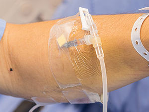 Apósitos Transparentes Personalizados de Material PU para Catéteres <span class=keywords><strong>IV</strong></span>, Apósitos para Heridas, Películas Adhesivas para Tatuajes con Puerto en U - Product Image 4