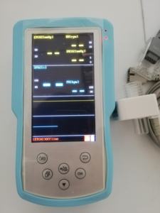 Etco2 capnografia capnógrafo dispositivo médico com etco2 linha de amostragem ambulância etco2 <span class=keywords><strong>co2</strong></span> fim <span class=keywords><strong>monitor</strong></span> maré - Product Image 5