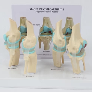 SCIEDU articulation du genou <span class=keywords><strong>squelette</strong></span> ressource pédagogique médical <span class=keywords><strong>humain</strong></span> 4 étapes modèle d'articulation du genou avec carte arrière modèle d'articulation du genou malade - Product Image 4