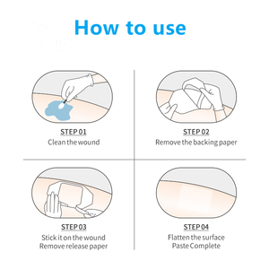 Venta directa de fábrica, vendaje transparente para heridas, vendaje de fijación de cánula IV para uso en hospitales y clínicas - Product Image 6