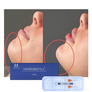 Prix de gros 3ml 5ml Produit de beauté <span class=keywords><strong>Acide</strong></span> <span class=keywords><strong>hyaluronique</strong></span> médical pour <span class=keywords><strong>injection</strong></span> dermique, pour l'allongement du <span class=keywords><strong>menton</strong></span> et le remodelage de la mâchoire - Product Image 6