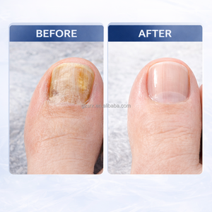 Lápiz para Uñas con <span class=keywords><strong>Aceite</strong></span> <span class=keywords><strong>de</strong></span> Árbol <span class=keywords><strong>de</strong></span> Té para Uñas Propensas a Hongos, Cuidado Hidratante <span class=keywords><strong>de</strong></span> Cutículas con <span class=keywords><strong>Propiedades</strong></span> Antifúngicas, Precisión - Product Image 6