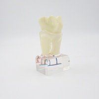 Modèle dentaire multifonctionnel en résine à 6 molaires, modèle anatomique du nerf, produit de démonstration pour l'éducation des dentistes et l'hygiène buccale