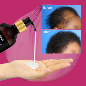 Salon personnalisé professionnel croissance des cheveux shampooing et après-<span class=keywords><strong>shampoing</strong></span> ensemble de soins capillaires peigne champoo ayurvédique cheveux Amla huile shampooing - Product Image 3