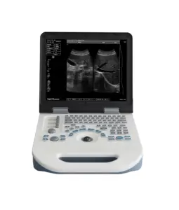 Haute Qualité Noir Et Blanc Machine À Ultrasons Système De Diagnostic Portable Scanner À Ultrasons Pour Être Humain MSLPU08