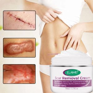 Crème Efficace <span class=keywords><strong>pour</strong></span> Enlever les Vieilles Cicatrices de Brûlure ELAIMEI Soins de la Peau - Product Image 6