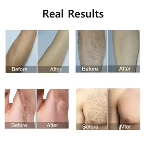 Corps Bikini Flash Épilateur Pulse <span class=keywords><strong>Laser</strong></span> Permanent Épilateur Indolore Femmes Hommes Universel IPL Épilation Équipement Domestique - Product Image 3