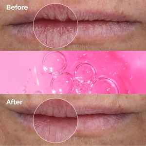 Sérum exfoliant pour les lèvres à l'extrait de PHA 5% pour le traitement de la sécheresse, l'hydratation, la lissage de la texture des lèvres et le volume des lèvres, marque privée - Product Image 4