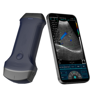 Sonde d'échographie portable sans fil 3-en-1 à double tête convexe linéaire cardiaque pour usage vétérinaire - Product Image 4