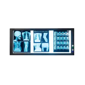 Máquina de escaneo ct para hospital, Visor de película de rayos x, pantalla LED de radiografía