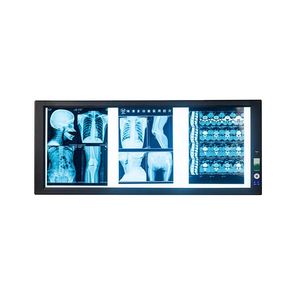 Visionneuse de films radiologiques LED électrique portable avec certification CB pour la radiographie hospitalière - Product Image 1