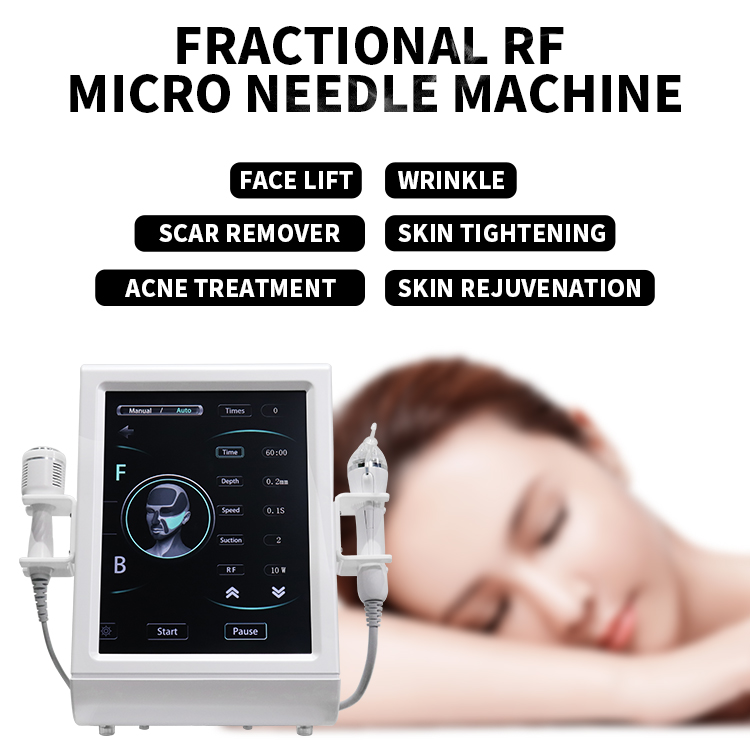 Fractional Microneedling RF Radio Frequency Microneedling Microneedle Radiofrequency Micro Needle Fractional Rf