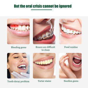 Portatile filo filo elettrico acqua USB fonte di alimentazione senza fili a getto di denti irrigatore per pulizia orale denti sbiancamento dentale - Product Image 4