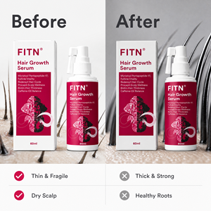 Spray de Suero para el Cuidado del Cabello Fitn, 60 ml, Péptidos, Biotina, Cafeína, Cuidado del Cuero Cabelludo, para Cabello Fino, Hombres - Product Image 5