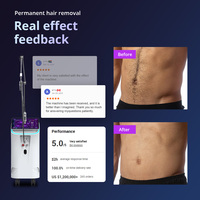 Modèle stationnaire d'épilation au laser professionnel Gentle Max Pro Nd Yag à longue impulsion pour une utilisation en salon esthétique de la peau