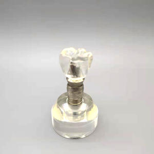 Educazione orale e dentale scienza medica rimovibile trasparente ingrandire il modello di impianto dentale - Product Image 5