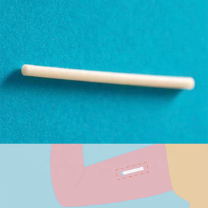 Medische Anticonceptie Implantaat In Arm Plastic Buis Extrusie Maken Machine Productielijn - Product Image 3