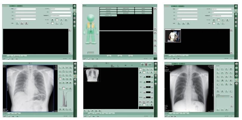 HDR65 65KW High Frequency Stationary Digital X Ray Machine from