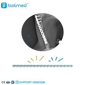 TOOLMED 수의사 ALPS 티타늄 재건 압축 잠금 플레이트 동물 애완 동물 정형 외과 용 동물 소모품 - Product Image 2