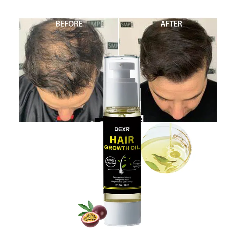 Haargroei Olie Fabriek Oem & Odm Mannen Haarproducten Anti-Roos Hydraterende Haargroei Olie Voor Mannen
