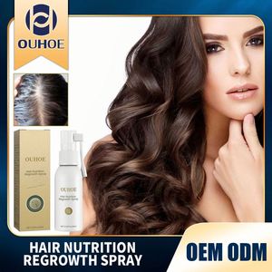 OUHOE 30 มล. เอสเซนส์ปลูกผมหลายส่วนผสม สเปรย์เข้มข้น ป้องกันผมร่วง หนาขึ้น ดกดำขึ้น สเปรย์ปลูกผม 7 วัน สำหรับผู้ชายและผู้หญิง - Product Image 2