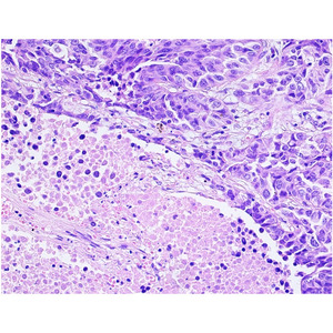 Optique trinoculaire de recherche biologique BestScope BS-2081L à champ super large pour laboratoire de pathologie et de cytologie - Product Image 6
