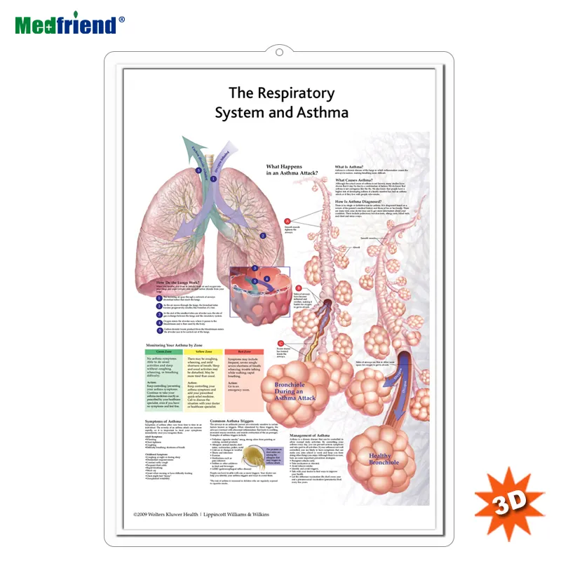 Gráfico/cartaz de parede anatômico humano médico 3D - Compreensão da asma